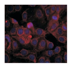 KDR (phospho Y1175), Rabbit anti-Human, Mouse, Rat, Polyclonal Antibody,