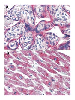 ADCYAP1R1 Rabbit anti-Human, Monkey, Polyclonal Antibody, Abnova 50&mu;g;