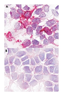 BDKRB2, Rabbit, Polyclonal Antibody, Abnova 50&mu;g; Unlabeled:Antibodies,