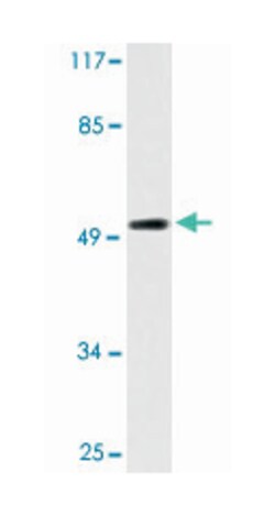 MKNK1 Rabbit anti-Human, Mouse, Polyclonal Antibody, Abnova 100&mu;L; Unlabeled:Antibodies,
