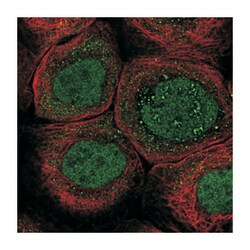 ZNF260, Rabbit, Polyclonal Antibody, Abnova 100&mu;L; Unlabeled:Antibodies,