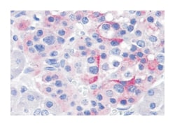 TRPV4 Rabbit anti-Bovine, Dog, Hamster, Horse, Human, Monkey, Mouse, Pig, Rat, Polyclonal Antibody, Abnova 50 &mu;g | Buy Online | Abnova Corporation | Fisher Scientific