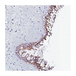 UGT2A2, Rabbit, Polyclonal Antibody, Abnova 100 &mu;L | Buy Online | Abnova Corporation | Fisher Scientific