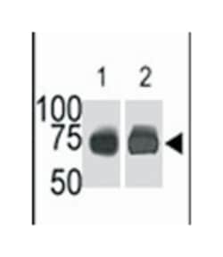 SPHK2 Rabbit anti-Human, Polyclonal Antibody, Abnova 400 &mu;L | Buy Online | Abnova Corporation | Fisher Scientific