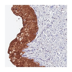 C6orf47, Rabbit, Polyclonal Antibody, Abnova 100 &mu;L | Buy Online | Abnova Corporation | Fisher Scientific