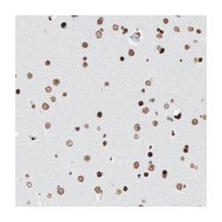 MECP2 Rabbit anti-Human, Polyclonal Antibody, Abnova 100 &mu;L | Buy Online | Abnova Corporation | Fisher Scientific
