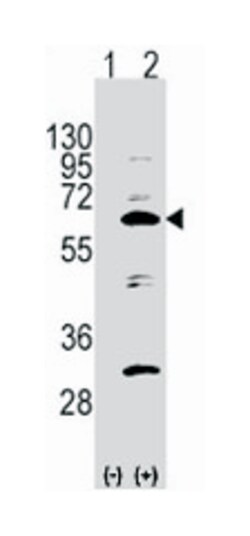 NAE1 Rabbit anti-Human, Polyclonal Antibody, Abnova 400 &mu;L | Buy Online | Abnova | Fisher Scientific
