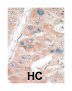 CDKN1A Rabbit anti-Human, Polyclonal Antibody, Abnova 400&mu;L; Unlabeled:Antibodies,