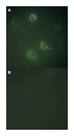 GRIN1 (phospho S890), Rabbit anti-Human, Mouse, Rat, Polyclonal Antibody,