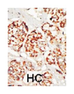 KSR1 Rabbit anti-Human, Polyclonal Antibody, Abnova 400 &mu;L | Buy Online | Abnova Corporation | Fisher Scientific