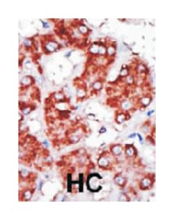 CPT1B, Rabbit, Polyclonal Antibody, Abnova 400&mu;L; Unlabeled:Antibodies,