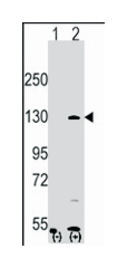 PARP1 Rabbit anti-Human, Polyclonal Antibody, Abnova 400&mu;L; Unlabeled:Antibodies,