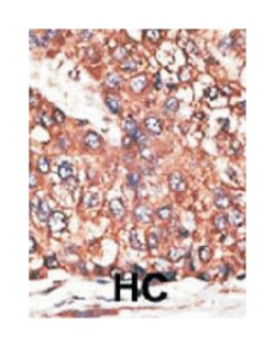 LEPR Rabbit anti-Human, Polyclonal Antibody, Abnova 400 &mu;L | Buy Online | Abnova Corporation | Fisher Scientific