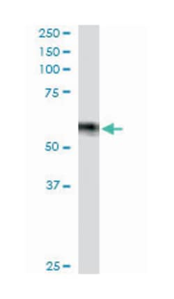 IRF6, Goat, Polyclonal Antibody, Abnova 100 &mu;g | Buy Online | Abnova Corporation | Fisher Scientific