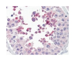MLL4, Goat, Polyclonal Antibody, Abnova 100 &mu;g | Buy Online | Abnova Corporation | Fisher Scientific