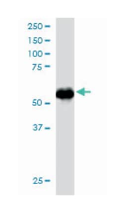 GPS1, Goat, Polyclonal Antibody, Abnova 100 &mu;g | Buy Online | Abnova Corporation | Fisher Scientific
