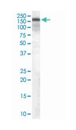 TSC1, Goat, Polyclonal Antibody, Abnova 100 &mu;g | Buy Online | Abnova Corporation | Fisher Scientific