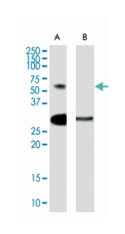 TCFL5, Goat, Polyclonal Antibody, Abnova 100 &mu;g | Buy Online | Abnova Corporation | Fisher Scientific
