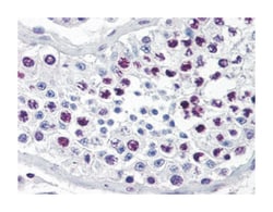 CCNA2 Rabbit anti-Human, Mouse, Rat, Polyclonal Antibody, Abnova 100&mu;L;