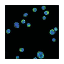 ITGB2, Mouse, Clone: 10E12, Abnova 100&mu;L; Unlabeled:Antibodies, Monoclonal