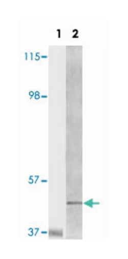 BLK, Mouse, Clone: 9D10B7, Abnova 100 &mu;L | Buy Online | Abnova | Fisher Scientific