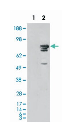 BRAF, Mouse, Clone: 1H12F1, 1H12G10, 1F12F11C9, Abnova 100&mu;L; Unlabeled:Antibodies,