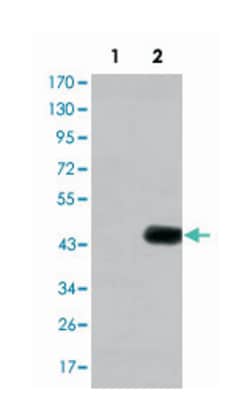 CEACAM5, Mouse, Clone: 1C7, Abnova 100&mu;L; Unlabeled:Antibodies, Monoclonal