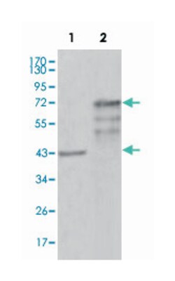 CHIT1, Mouse, Clone: 1D9G2, 1D9G4, 2B4G3, Abnova 100&mu;L; Unlabeled:Antibodies,