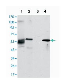 ABCG2, Mouse, Clone: 1H2, Abnova 100&mu;L; Unlabeled:Antibodies, Monoclonal