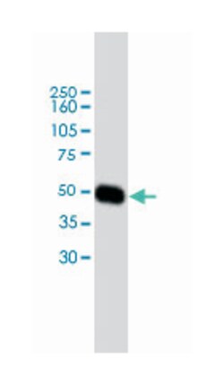 SERPINF1, Mouse, Clone: 14K, Abnova 50&mu;g; Unlabeled:Antibodies, Monoclonal