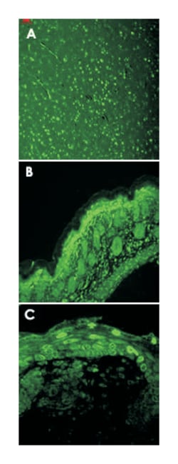 Cacna1d, Mouse, Clone: S48A-9, Abnova 100 &mu;g | Buy Online | Abnova | Fisher Scientific