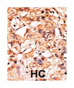 GSK3B (phospho S21/29), Rabbit anti-Human, Mouse, Polyclonal Antibody,