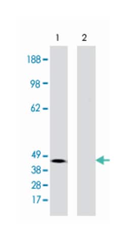 LPAR2 Rabbit anti-Human, Polyclonal Antibody, Abnova 100&mu;g; Unlabeled:Antibodies,