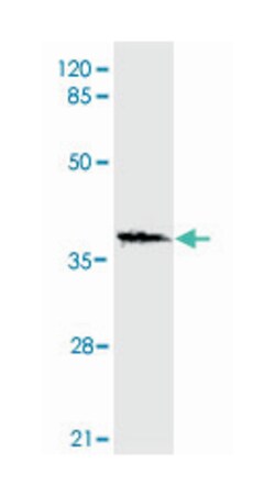 HNF1A, Mouse, Monoclonal Antibody, Abnova 100&mu;g; Unlabeled:Antibodies,