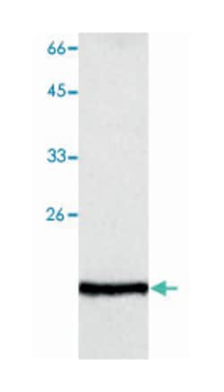 GLO1, Mouse, Clone: 14, Abnova 100&mu;g; Unlabeled:Antibodies, Monoclonal
