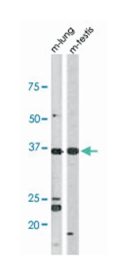 TP53 (phospho T18), Rabbit anti-Human, Mouse, Polyclonal Antibody, Abnova