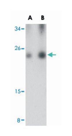 C16orf5 Rabbit anti-Human, Mouse, Polyclonal Antibody, Abnova 100&mu;g;