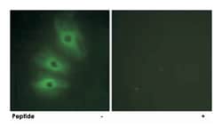 ADCY5/ADCY6, Rabbit, Polyclonal Antibody, Abnova 100&mu;g; Unlabeled:Antibodies,