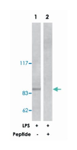 IKBKB Rabbit anti-Human, Mouse, Rat, Polyclonal Antibody, Abnova 100&mu;g;