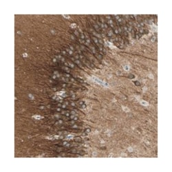 CXorf61, Rabbit, Polyclonal Antibody, Abnova 100&mu;L; Unlabeled:Antibodies,