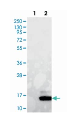 GUCA2A Rabbit anti-Human, Polyclonal Antibody, Abnova 100&mu;L; Unlabeled:Antibodies,