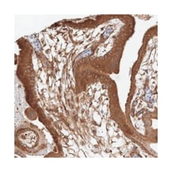 CSMD3, Rabbit, Polyclonal Antibody, Abnova 100 &mu;L | Buy Online | Abnova Corporation | Fisher Scientific