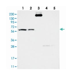 KCND2 Rabbit anti-Human, Polyclonal Antibody, Abnova 100&mu;L; Unlabeled:Antibodies,