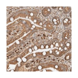 SDCCAG3, Rabbit, Polyclonal Antibody, Abnova 100 &mu;L | Buy Online | Abnova Corporation | Fisher Scientific