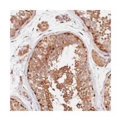 SEMA3C, Rabbit, Polyclonal Antibody, Abnova 100 &mu;L | Buy Online | Abnova Corporation | Fisher Scientific
