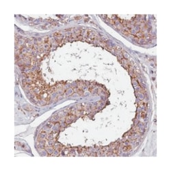 FAM70B, Rabbit, Polyclonal Antibody, Abnova 100 &mu;L | Buy Online | Abnova Corporation | Fisher Scientific