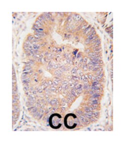 TASP1 Rabbit anti-Human, Mouse, Polyclonal Antibody, Abnova 400&mu;L; Unlabeled:Antibodies,