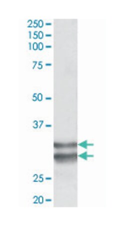 KLF13, Goat, Polyclonal Antibody, Abnova 100 &mu;g | Buy Online | Abnova | Fisher Scientific