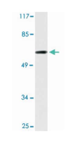 RORA Rabbit anti-Human, Polyclonal Antibody, Abnova 100 &mu;L | Buy Online | Abnova | Fisher Scientific