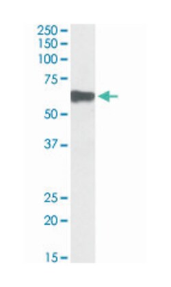 MYOT, Goat, Polyclonal Antibody, Abnova 100 &mu;g | Buy Online | Abnova Corporation | Fisher Scientific
